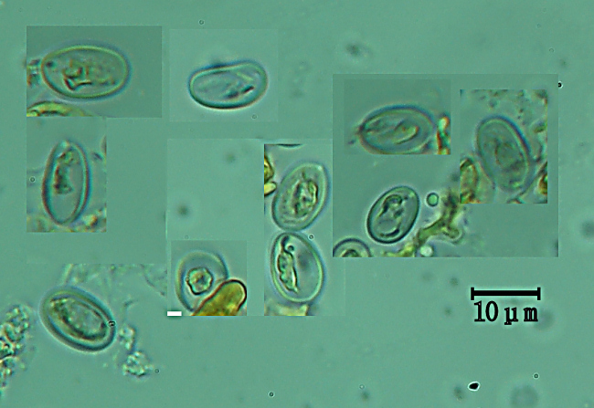 Amyloathelia amylacea (Bourdot & Galzin) Hjortstam & Ryvarde